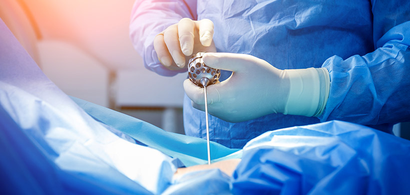 Dr. Cink bei einer minimal-invasiven Operation an der Wirbelsäule nach einem Bandscheibenvorfall