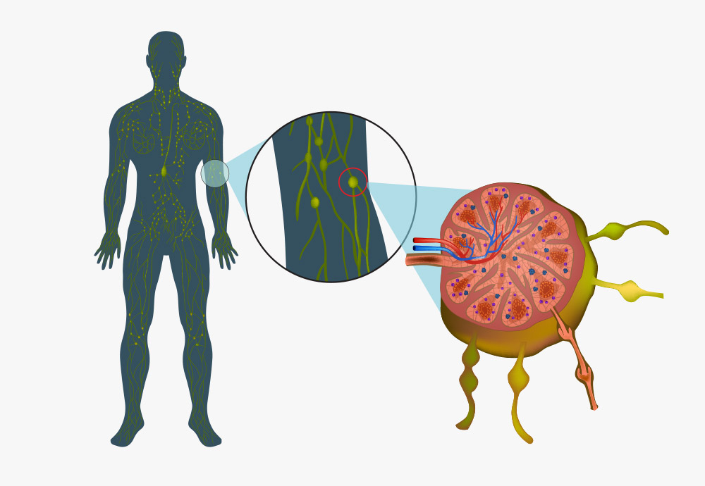 Das Lymphsystem erklärt mit Zeichnungen von Lymphgefäßen, Arterien und Venen und einem Körper mit Lymphsystem